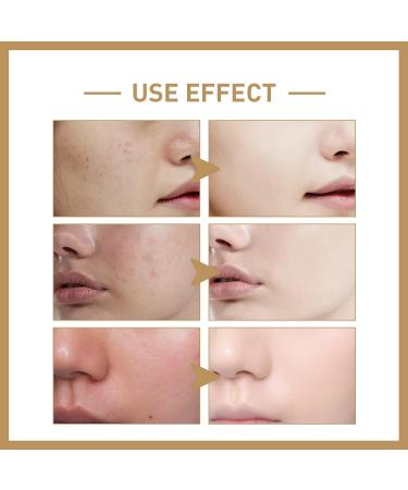 Face Glow Serum with Propolis and Niacinamide Face Serum for Women Korean Skincare Serum Moisturiser Face Hydrating Serum Plump and Smooth Brightening Serum Anti Aging Serum for Face Fade Fine Lines - Buy Online on GoSupps.com