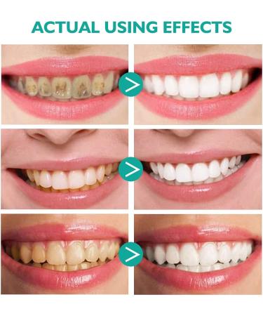 Whitening Toothpaste Foam 360 - Ultra-fine Mousse for Deep Gum Cleaning & Stain Removal 60ml Travel-Friendly Oral Care - Buy Online on GoSupps.com