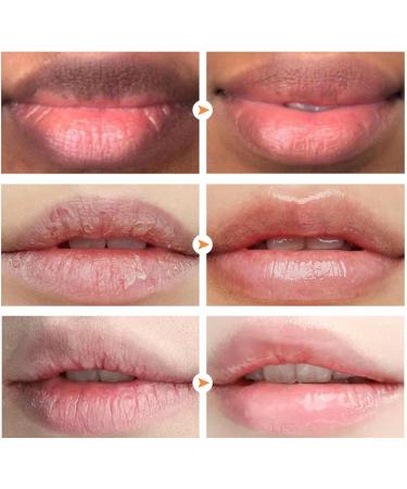 Botiniv Lip Scrub | Bubble Lip Scrubs Exfoliating and Moisturizing | Moisturizing Lip Balm Lip Scrub Night Sleep Effectively Moisturizes and Repairs Dry Lips Lip Care - Buy Online on GoSupps.com