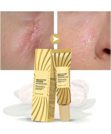 Yuemei Scar Vanishing Cream - Strengthen Skin Repair, Remove Old Scars & Stretch Marks | Suitable for All Skin Types - Buy Online on GoSupps.com