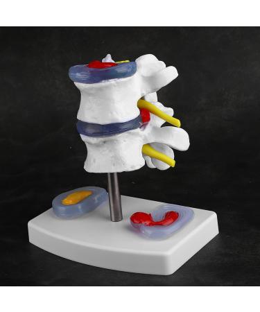 Anatomical Lumbar Intervertebral Disc Model - Spine Demonstration for Training & Education | International Shipping Available - Buy Online on GoSupps.com