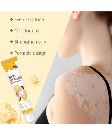 (100% Effective) 4Pcs Bee Venom Care Cream Vitiligo Bee Venom Cream 20g / 0.71oz - Buy Online on GoSupps.com