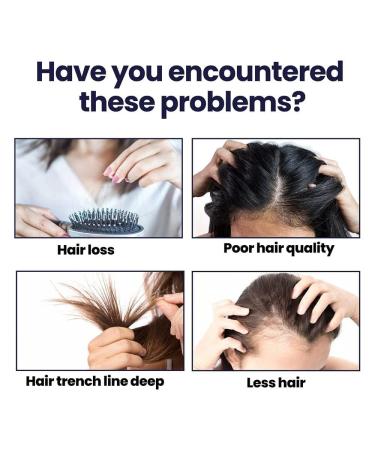 Blusoms Hairgrowth Formula Serum Spray - Set of 2 | Promotes Healthy Hair Growth - Buy Online on GoSupps.com