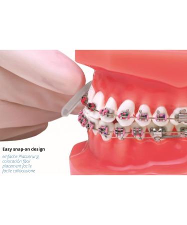 Buy Mouth Protection for Braces | Reusable Taste-Free Orthodontic Wax Alternative | Prevent Lip Wounds - Buy Online on GoSupps.com