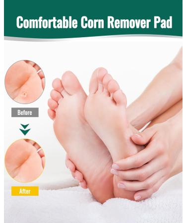 Max Strength Corn Remover Plaster - 24 Pads for Toes & Feet | Large & Small Sizes | Effective Corn Removal - Buy Online on GoSupps.com