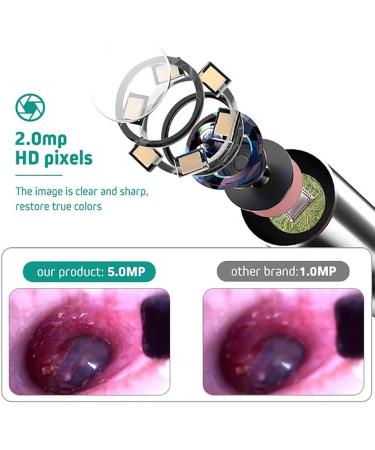 RKXKJ 7-Inch Ear Wax Removal Camera - 3.9mm Ear Scope with LED Light 2 Million Pixels - Safe for Children & Adults - Buy Online on GoSupps.com