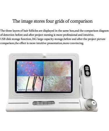 Skin Diagnosis Hair Analyzer 11 Inch Skin Scalp Detector with 50X 200X Dual Lens and 16G Storage 10 Million Pixel and 4 Spectrum Detection Pictures Comparison for Spa Salon Home Use - Buy Online on GoSupps.com