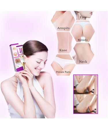 Premium Dark Spot Remover for Face - Niacinamide Cream for Age Spots Sun Spots and Freckles - 20G - Buy Online on GoSupps.com