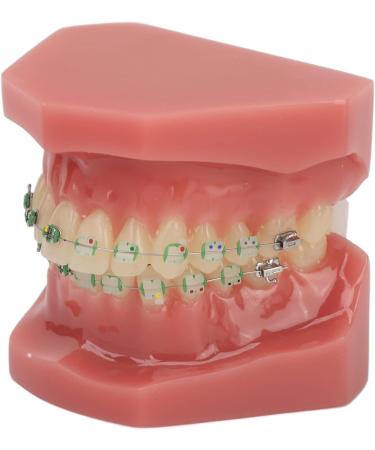 Orthodontic Bracket Model - Dental Resin Model & Portable Metal Wire for Student Learning - Buy Online on GoSupps.com