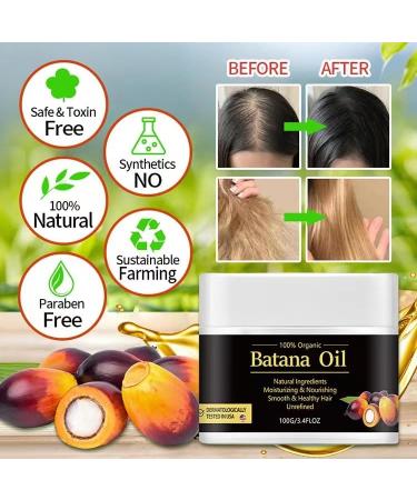 Batana Hair Oil for Growth - 100% Raw Batana Butter Oil from Honduras | Anti-Hair Loss & Thicker Hair | Perfect Women's Gift - Buy Online on GoSupps.com