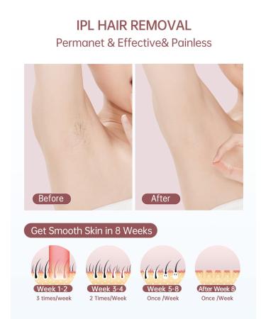 Rose IPL Hair Removal Device with Cooling System | Upgraded to 999,900 Flashes | Permanent Hair Removal for Women & Men - Shop Now! - Buy Online on GoSupps.com