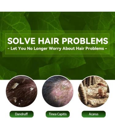 Eczema Psoriasis Anti Dandruff Shampoo for Soothing Dry, Itchy Scalp (200ml) - Buy Online on GoSupps.com