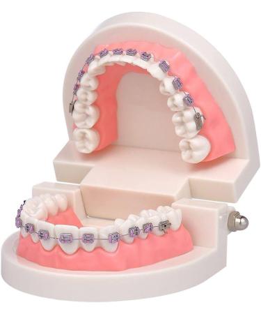 Dytah Orthodontic Demonstration Model - Teeth Study Model with Metal Arch Wire & Brackets for Effective Teaching - Buy Online on GoSupps.com