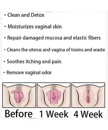 DENGWANG Anniecare Instant Anti-Itch Detox Slimming Capsules - Slimming, Firming, Repair & Pink, Natural Formula (1 Pc) - Buy Online on GoSupps.com