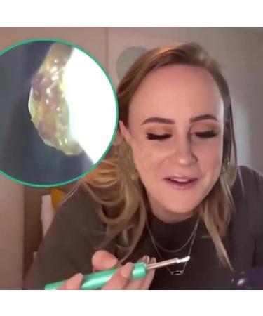 Buy 1080P HD Wireless Ear Cleaner Set with Camera - Early Ward Removal Tool LED Light & 4 Ear Tips for Adults (Black) - International Shipping Available - Buy Online on GoSupps.com