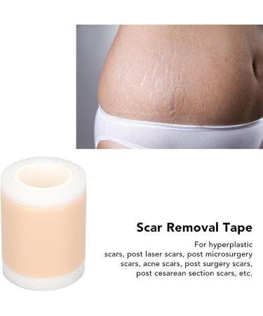 Reusable Silicone Scar Removal Tape for Postpartum Recovery and Surgery Scars - Buy Online on GoSupps.com