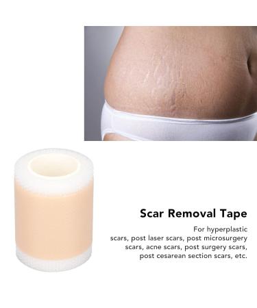 Scar Removal Tape Roll - Self Adhesive, Waterproof & Reusable for Postpartum Recovery | Restores Elasticity - Buy Online on GoSupps.com