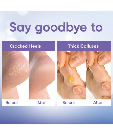 Foot Peel Mask for Baby Soft Skin - Exfoliating Lavender 2 Pairs - Remove Dead Skin, Foot Care Spa with Aloe Vera Gel - Men and Women Feet Peeling Mask - Buy Online on GoSupps.com