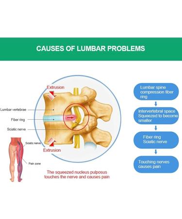 Buy Inflatable Decompression Belt for Lower Back Pain Relief | Lumbar Traction Device with 28 Air Columns - Large Red - Buy Online on GoSupps.com