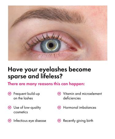 TOPLASH Eyelash Growth Serum - Natural, Cruelty-Free, Hypoallergenic Formula for Longer, Thicker Brows & Lash Boost - 0.1 fl.oz - Buy Online on GoSupps.com