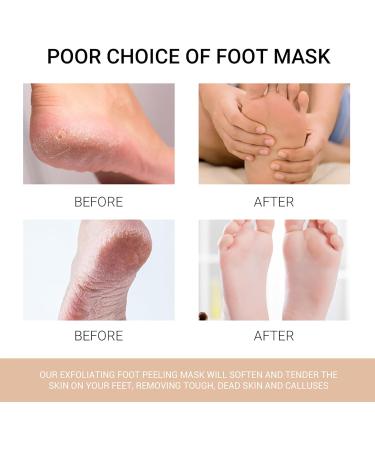 Foot Mask - 3 Pairs Peeling & Moisturizing Socks for Dry Cracked Feet - Foot Spa Treatment for Men & Women - Buy Online on GoSupps.com