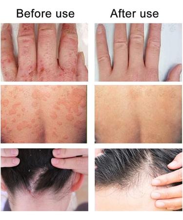 2 Chapped Cream Face Hydrating Moisturizer Moisture Cream for Face Foot Moisturizer Foot Cream Dead Skin Cream Exfoliator Cream Anti Drying Cream Abs Body Lotion Moisturizing - Buy Online on GoSupps.com