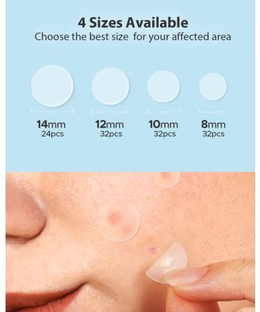 LitBear Acne Pimple Patches - Day and Night Set | 180 Dots with Witch Hazel, Tea Tree & Calendula Oil | Extra Adhesion for Face | Zit Patch AM + PM - Buy Online on GoSupps.com