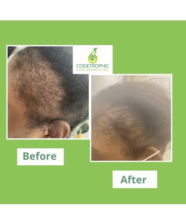 Organic Rosemary Hair Growth Oil - 2.0 Fl Oz - Natural Hair Treatment - Buy Online on GoSupps.com