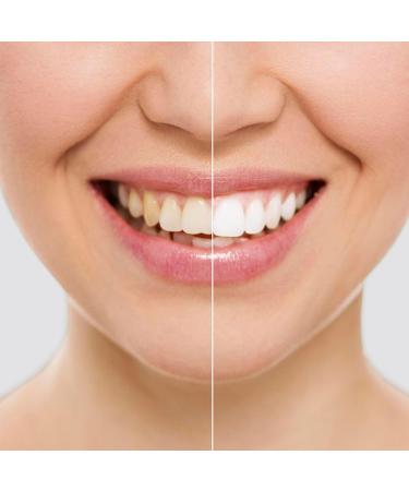 Bandes de Blanchiment Dentaire Wripes InnovaGoods - Buy Online on GoSupps.com