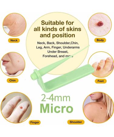 Micro Skin Tag Remover Kit with 24 Bands for Face, Neck, and Body - Mole and Skin Tag Removal Tool for 2-4mm Micro Skin Tags - Buy Online on GoSupps.com