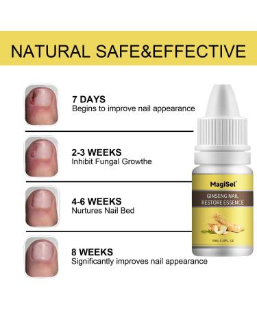  MagiSel Nail strengthening nail strengthening polish nail care oil with ginseng oil repairs and strengthens damaged nails 10 ml - Buy Online on GoSupps.com