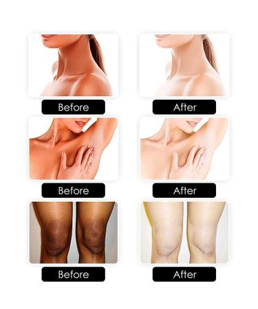 Orange Vitamin C Handmade Soap - 99% Natural Organic Soap (2PCS) - Buy Online on GoSupps.com