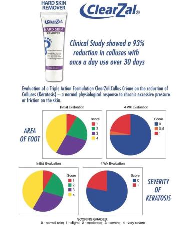 Clearzal Foot Cream for Hard Skin - Callus and Corn Removal, Hydrating Triple Action Formula with Aloe Vera - 3.4oz - Buy Online on GoSupps.com