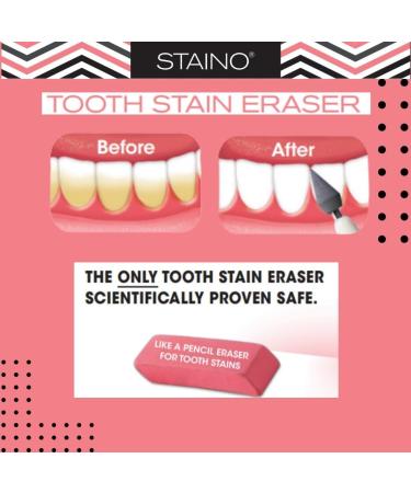 Staino Tooth Stain Eraser Dental Tool - 2 Erasers/Unit - Buy Online on GoSupps.com