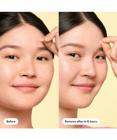 Buy Hero Cosmetics Mighty Patch Mini Invisible+ Patches - Extra Small Hydrocolloid Acne Pimple Patches (30ct) - Effective Zit & Blemish Coverage for All Skin Types - Buy Online on GoSupps.com