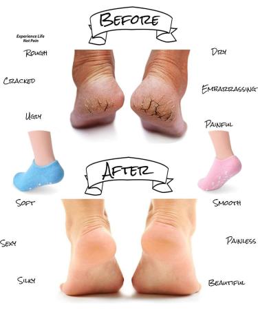 PRO 11 WELLBEING Moisturising Socks for Dry Cracked Heels and Feet - Pink - Buy Online on GoSupps.com