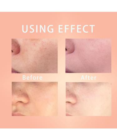 Facial Exfoliating Gel Orange Enzymes Exfoliating Purifying Exfoliating Gel for Smooth and Glowing Skin Deep Cleansing Pore Gentle for All Skin Types2PCS - Buy Online on GoSupps.com