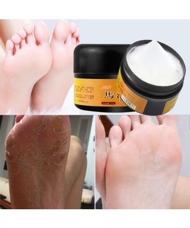 AllbestAye Foot Repair Cream - Heal Cracked Heels & Dry Feet | Moisturizing Callus Care for Soft Skin - 50g - Buy Online on GoSupps.com