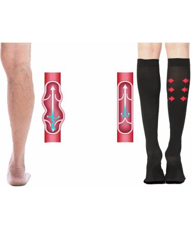 WSYKC Compression Socks | Weight Loss Support | 20-30 mmHg | Plus Size XXL-XXXXL | Black Closed Toe | Thick Calves - Buy Online on GoSupps.com