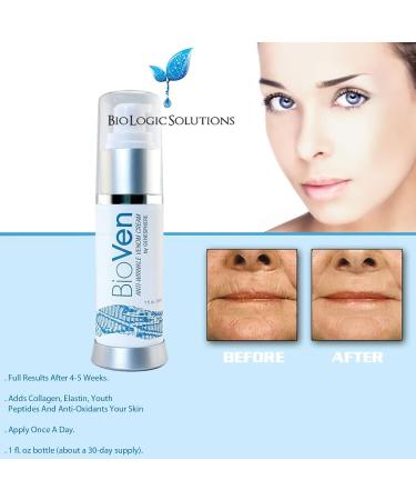 Buy BioVen Anti-Wrinkle Venom Cream by Biologic Solutions | 1 oz | Rejuvenate Skin & Reduce Wrinkles - Fast International Shipping - Buy Online on GoSupps.com