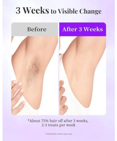 Hikyskin IPL Laser Hair Removal Device - Painless & Smooth Full Body Hair Removal for Women and Men at Home - 9 Levels Sapphire CooIing Technology - Unlimited Flash - Purple - Buy Online on GoSupps.com