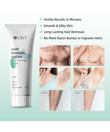 GKV Hair Removal Cream - Painless Depilatory Gel for Men & Women | Skin-Friendly Intimate Hair Removal | 4.06 Fl Oz - Buy Online on GoSupps.com