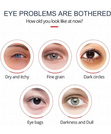2023 New Openeyes Awaken Peptide Lifting Eye Gel for Women Peptide Gel Openeyes Lifting Eye Gel for Women Lifts Firming Anti-wrinkle Eye Tightener Dark Circles Reducing Eye Cream (2sets) - Buy Online on GoSupps.com