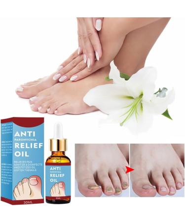 Ingrown Toenail Treatment Ingrown Toenail Treatment Drop Toenail Anti Paronychia Relief Oil Fungal Nail Treatment for Toenails Ingrown Toenail Treatment Nail Growth Treatment Nail Care (30ML) - Buy Online on GoSupps.com