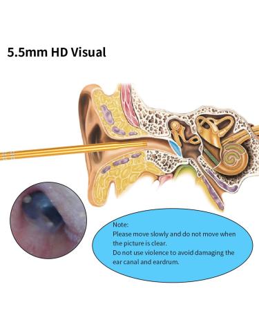 3-in-1 Earwax Removal Kit with Endoscope | Ear Pick & Cleaner | HD Visual Ear Spoon | Multifunctional Ear Inspection Tool - Buy Online on GoSupps.com