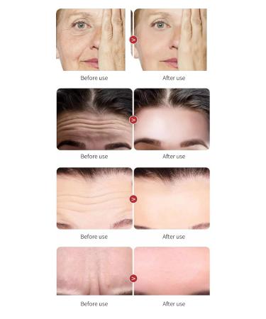 Buy Superior Collagen Anti-Wrinkle Cream - Best International Shipping & Results - Buy Online on GoSupps.com