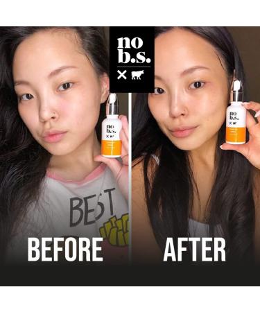 Shop No B.S. Skincare Minis Kit | Vitamin C & E Serum Retinol Cream Eye Cream & Acne Patches | Trial Size Gluten Free & International Shipping - Buy Online on GoSupps.com