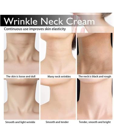 Spain NECKPON 2 Pack Hydrolyzed Collagen Neck Cream Neck Firming Cream Whiten Swan Neck and Rejuvenate Sagging Skin - Buy Online on GoSupps.com