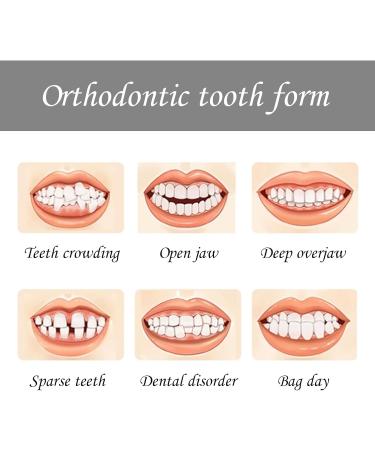 2-Piece Teeth Whitening Mouth Trays | Durable & Reusable Gum Shield | Dental Oral Care Kit for Protecting & Whitening Teeth - Buy Online on GoSupps.com