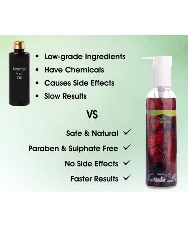 Urban Yog Ayurvedic Kalonji Onion Black Seed Oil for Hair, Face & Skin Care | 7 Fl Oz - Promotes Growth for Dry and Damaged Hair - Buy Online on GoSupps.com